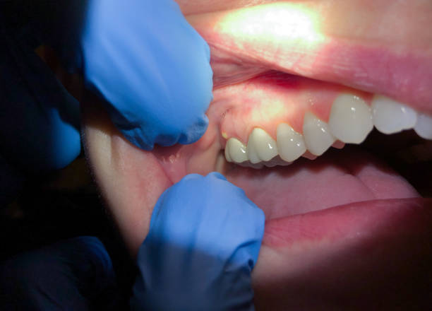 Best Orthodontic Emergency Dentist in Lakes Of The Four Seasons, IN