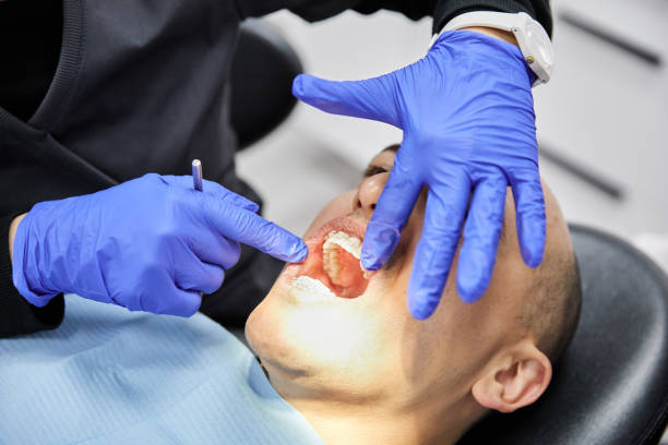 Best Emergency Dental Care for Abscessed Tooth in Lakes Of The Four Seasons, IN