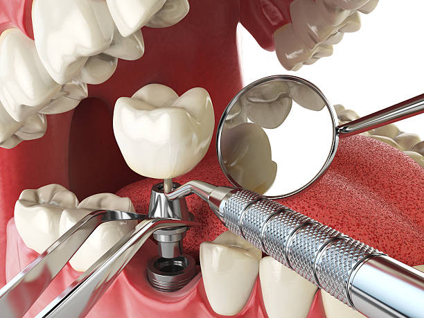 Best Emergency Dental Extractions in Lakes Of The Four Seasons, IN